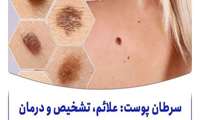 راه‌های موثر در پیشگیری از سرطان پوست